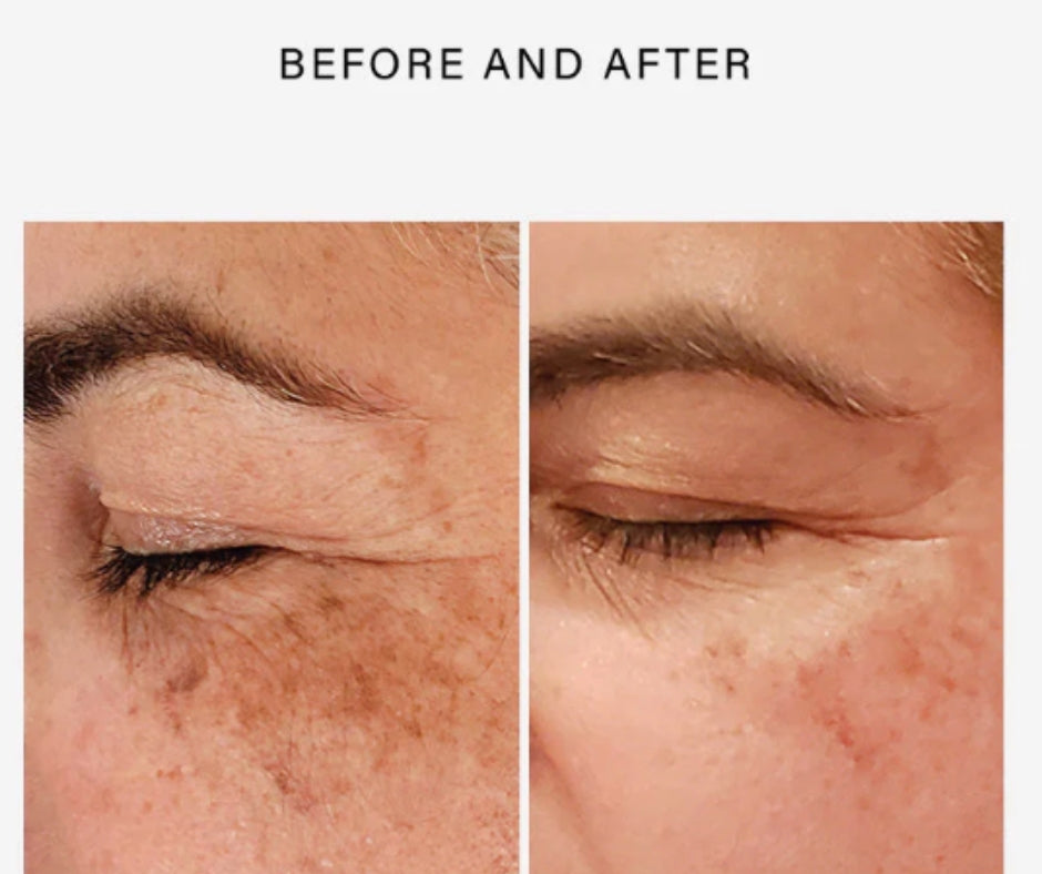 Vivant FF3 Triple Repair Complex