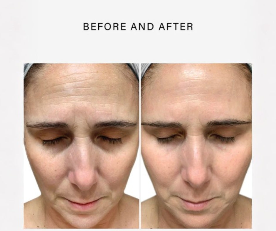 Vivant FF3 Biointensive GF - Estrogen Depleted Skin